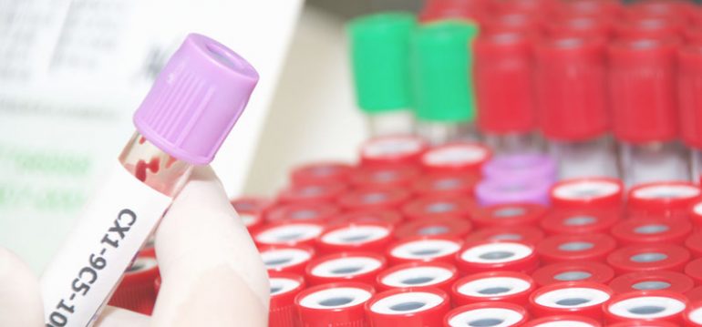 Рак бронхов