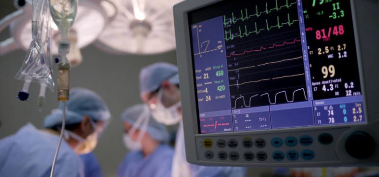 Операции МОС