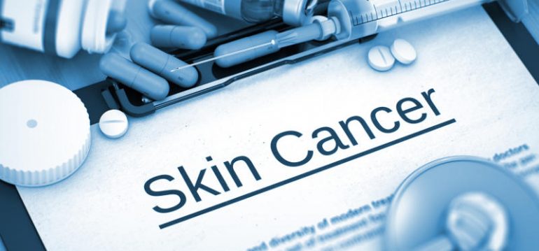 Рак кожи